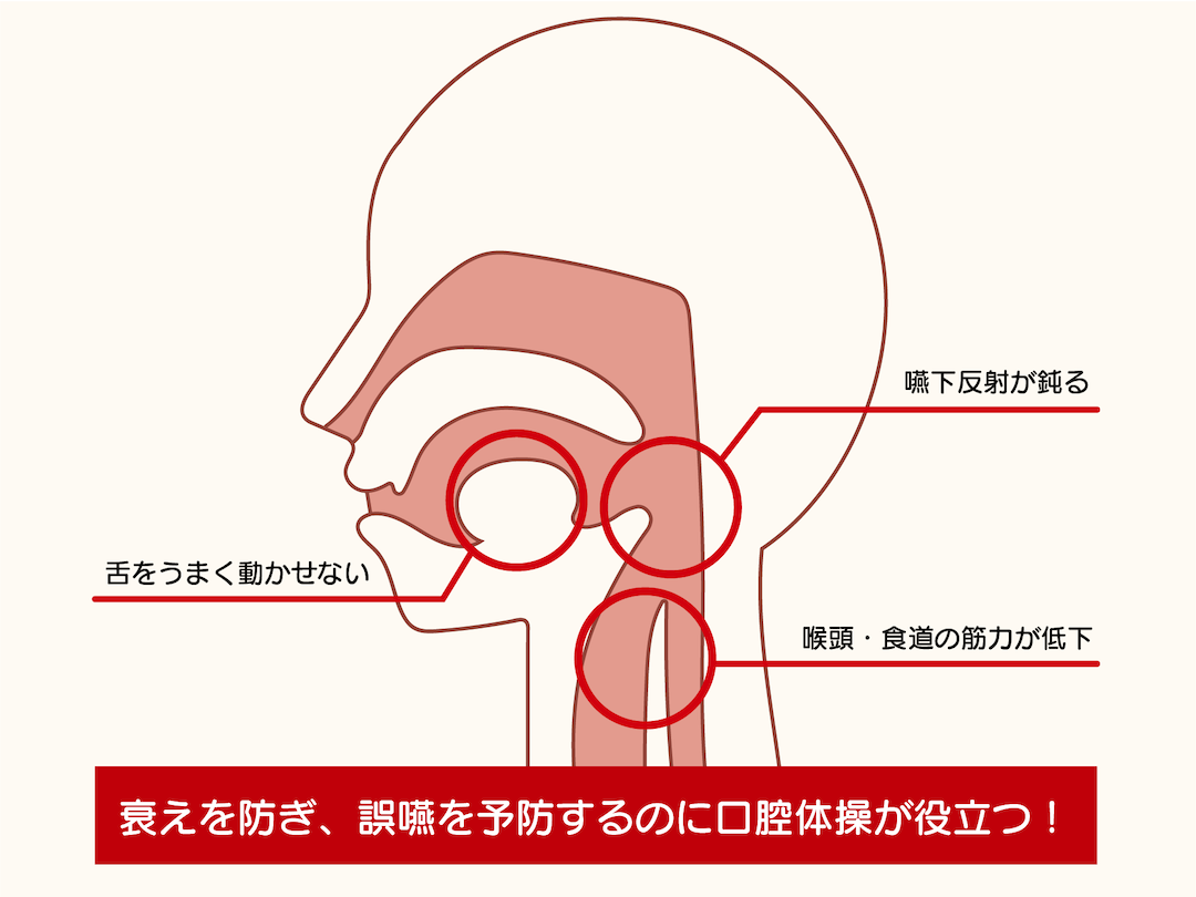 嚥下障害・発声のしにくさとの関係がわかる図解