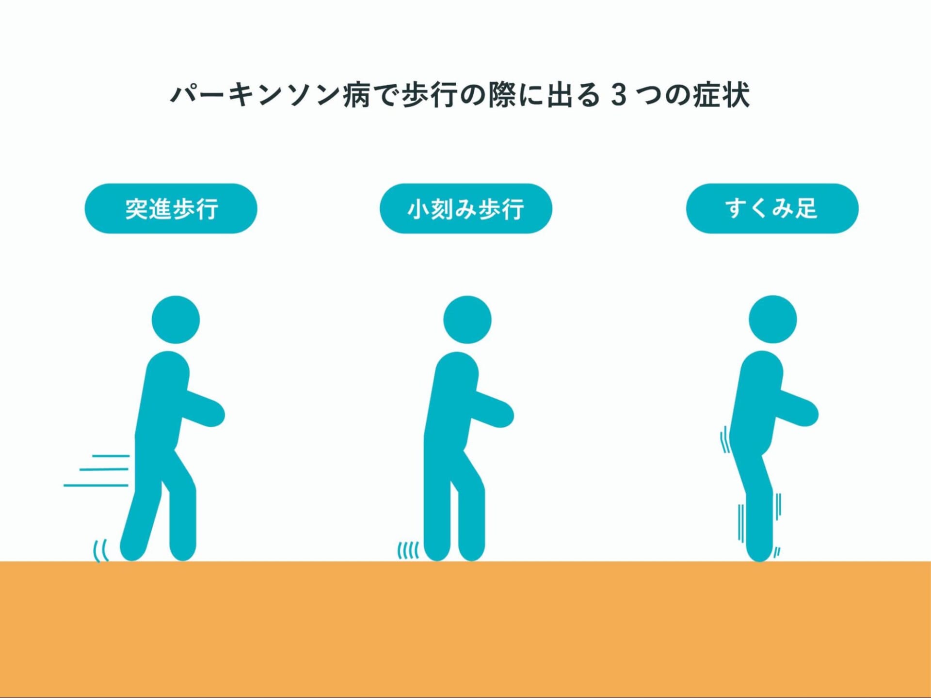 「突進歩行」「小刻み歩行」「すくみ足」症状を表現したイラスト
